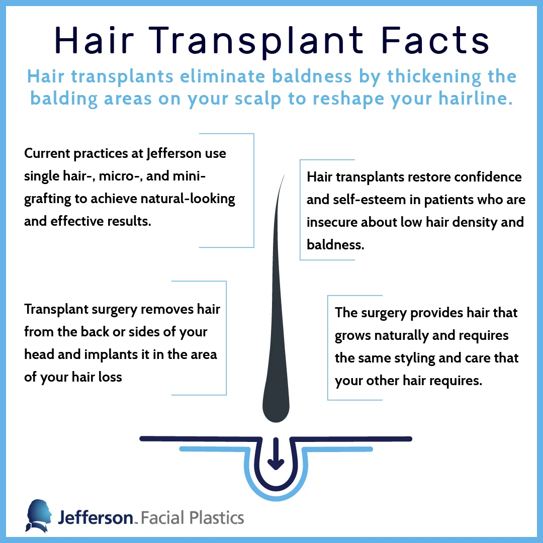 Hair Transplant social image